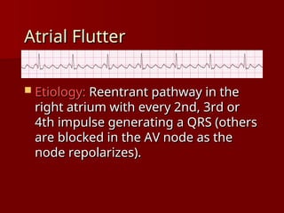 complete ECG interpretation presentation.ppt