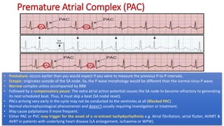 Complete EKG Interpretation Course | PPTX