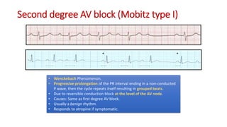 Complete EKG Interpretation Course | PPTX
