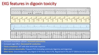 Complete EKG Interpretation Course | PPTX