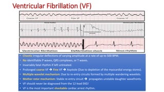 Vf Wave Complete EKG Interpretation Course | PPTX
