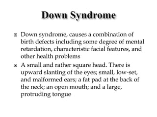  Down syndrome, causes a combination of
birth defects including some degree of mental
retardation, characteristic facial features, and
other health problems
 A small and rather square head. There is
upward slanting of the eyes; small, low-set,
and malformed ears; a fat pad at the back of
the neck; an open mouth; and a large,
protruding tongue
 