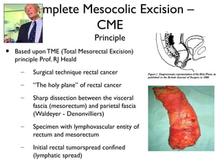 Complete Mesocolic Excision –
CME
Principle
• Based upon TME (Total Mesorectal Excision)
principle Prof. RJ Heald
– Surgic...