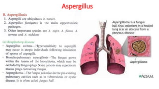 Aspergillus
 