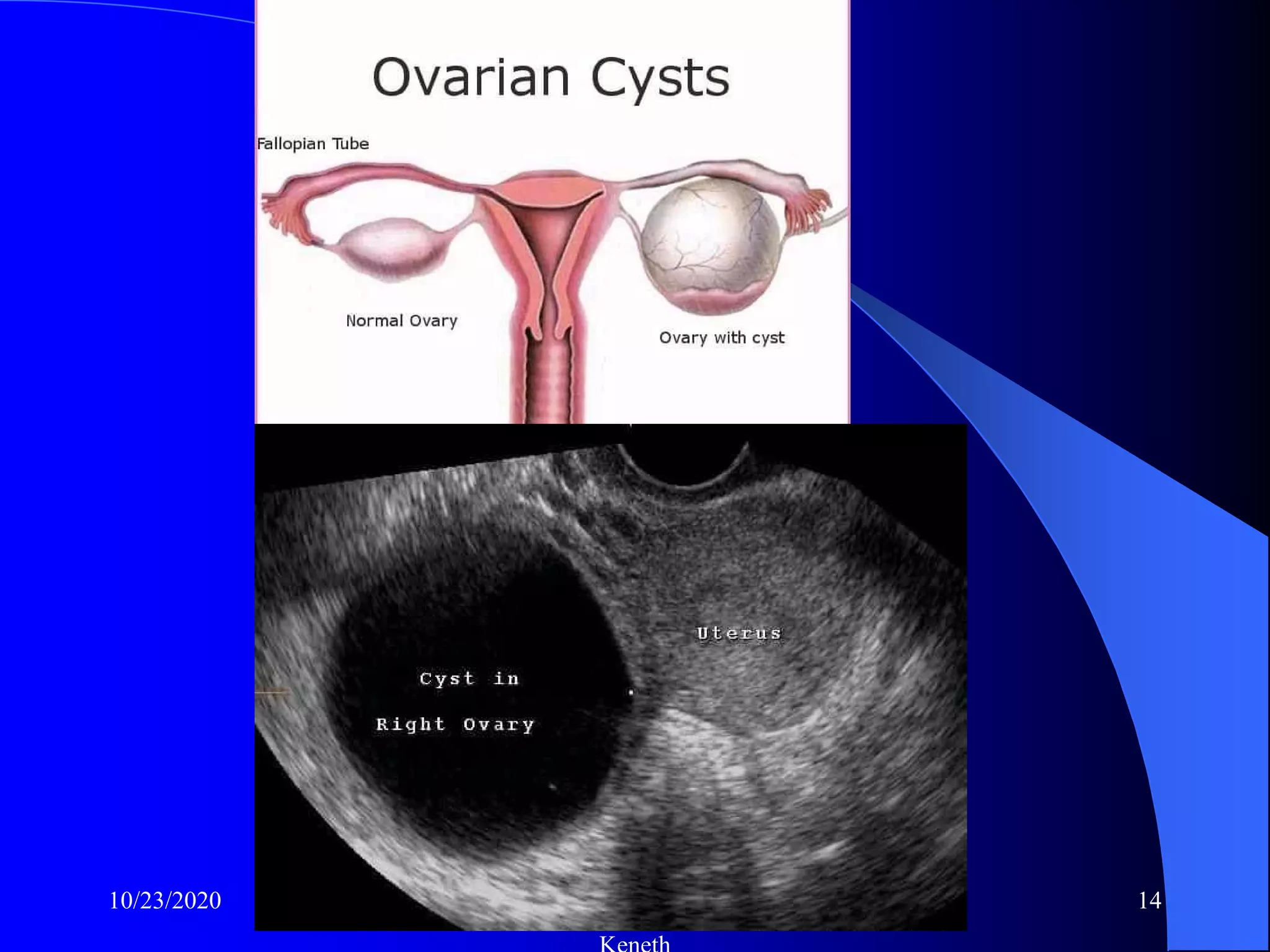 Complete obstetrics ultrasound radiology training nchanji nkeh keneth | PDF