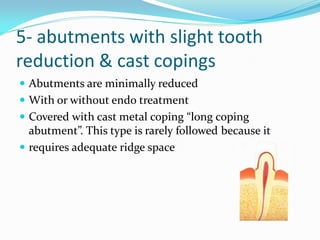 5- abutments with slight tooth
reduction & cast copings
 Abutments are minimally reduced
 With or without endo treatment
 Covered with cast metal coping “long coping
abutment”. This type is rarely followed because it
 requires adequate ridge space
 