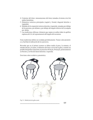 177177177177177
4. Contorno del tórax: mensuraciones del tórax tomadas al mismo nivel de
ambos hemitórax.
5. Diámetros torácicos principales (sagital y frontal, diagonal derecho e
izquierdo).
6. Medidas de la expansión torácica derecha e izquierda, tomadas por debajo
de los pezones, por delante y por debajo del ángulo inferior de la escápula
por detrás.
7. Las mediciones oblicuas: distancia que separa en ambos lados la apófisis
espinosa de L4, de la prominencia del ángulo del acromion.
Estas mediciones deben ser avaladas periódicamente. Tienen valor pronósti-
co y facilitan la indicación de los ejercicios.
Recordar que en el primer examen se deben medir el peso, la estatura, el
tamaño del pie y la mano, el diámetro del tórax a nivel de la giba y cuando sea
posible fotografiar al paciente en posiciónAPde pie, PAde pie, posteroanterior
en flexión y en flexión lateral derecha e izquierda.
Esto tiene valor evolutivo y pronóstico.
Fig. 9.1. Medición de la giba costal.
 