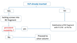 VLP already inserted
NOYES
locking screws into
RC fragment
persistent
instability ?
yes
Stabilization of RC fragment
with F-S FIX or Pin fix
No
Proceed to
ulnar column
 