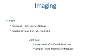 Imaging
 X-ray
 Standard : AP , Lateral , Oblique
 Additional views ( SF , VR ,FIA ,DUC )
CT Scan
 more useful after Closed Reduction
Complex , multi-fragmentary fractures
 