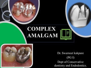 COMPLEX
AMALGAM
Dr. Swarneet kakpure
(PG I)
Dept of Conservative
dentistry and Endodontics.
 