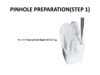 PINHOLE PREPARATION(STEP 1)