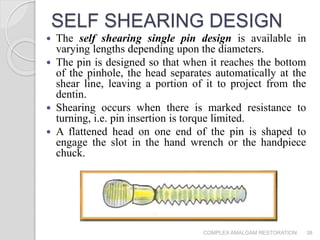 Pin Shearing Example Complex amalgam restoration | PPTX