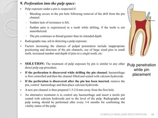 Complex amalgam restoration | PPTX
