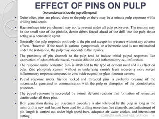 Pin Dissolution Complex amalgam restoration | PPTX