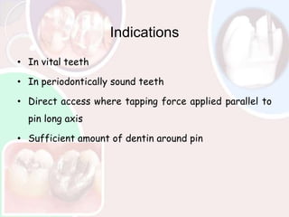 Parallel Indication Complex amalgam restoration | PPTX