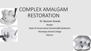 COMPLEX AMALGAM
RESTORATION
Dr. Basavan Gowda
Reader
Dept.of Conservative Dentistry&Endodontics
Navodaya Dental College
Raichur
 