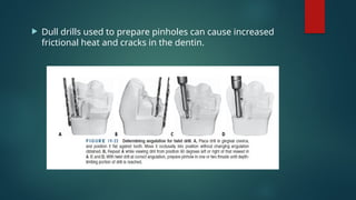  Dull drills used to prepare pinholes can cause increased
frictional heat and cracks in the dentin.
 