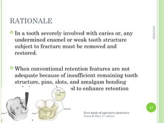 Week Teeth's COMPLEX AMALGAM RESTORATIONS.pptx....... | PPTX