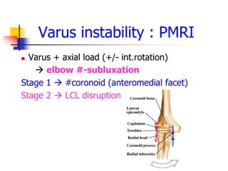 Varus Load Complex elbow injury 2013 | PPT
