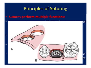Suture Function Complex exodontia contemporary chapter 8.pptx