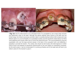 Complex non skeletal proplems.pptx orthodontics | PPTX