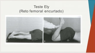 Teste Ely
(Reto femoral encurtado)
 