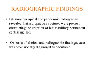 RADIOGRAPHIC FINDINGS
• Intraoral periapical and panoramic radiographs
revealed that radiopaque structures were present
obstructing the eruption of left maxillary permanent
central incisor.
• On basis of clinical and radiographic findings, case
was provisionally diagnosed as odontome
 