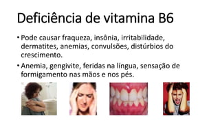 Deficiência de vitamina B6
• Pode causar fraqueza, insônia, irritabilidade,
dermatites, anemias, convulsões, distúrbios do
crescimento.
• Anemia, gengivite, feridas na língua, sensação de
formigamento nas mãos e nos pés.
 