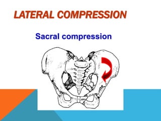 Lateral Compression Text Complex pelvic trauma 1 | PPTX