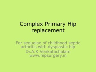 Complex Primary Hip
replacement
For sequelae of childhood septic
arthritis with dysplastic hip
Dr.A.K.Venkatachalam
www.hipsurgery.in
 