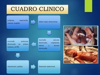 CUADRO CLINICO
polípnea, taquicardia,
cianosis, quejido,
aleteo nasal, retracciones,
murmullo vesicular
disminuido, crepitantes,
edema y diuresis
disminuida,
murmullo pulmonar
disminuido en ambos
campos y el RN
Hipotensión, palidez. Distensión abdominal.
 