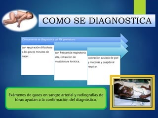 COMO SE DIAGNOSTICA
Clínicamente se diagnostica un RN prematuro
con respiración dificultosa
a los pocos minutos de
nacer.
con frecuencia respiratoria
alta, retracción de
musculatura torácica,
coloración azulada de piel
y mucosas y quejido al
respirar.
Exámenes de gases en sangre arterial y radiografías de
tórax ayudan a la confirmación del diagnóstico.
 