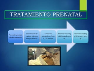 TRATAMIENTO PRENATAL
Prevención y manejo
de parto prematuro.
Determinación de
madurez pulmonar
fetal y aceleración.
Corticoides
antenatales en fetos
24 – 28 semanas.
Betametasona 12mg
c/24 horas x 2 veces
IM
Dexametasona 6mg
c/12 horas x 4 veces
IM.
 