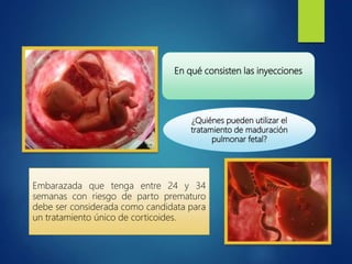 En qué consisten las inyecciones
¿Quiénes pueden utilizar el
tratamiento de maduración
pulmonar fetal?
Embarazada que tenga entre 24 y 34
semanas con riesgo de parto prematuro
debe ser considerada como candidata para
un tratamiento único de corticoides.
 