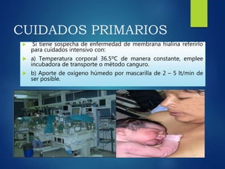 CUIDADOS PRIMARIOS
 Si tiene sospecha de enfermedad de membrana hialina referirlo
para cuidados intensivo con:
 a) Temperatura corporal 36.5ºC de manera constante, emplee
incubadora de transporte o método canguro.
 b) Aporte de oxígeno húmedo por mascarilla de 2 – 5 lt/min de
ser posible.
 