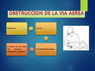 RN apneicos Cianosis
Poco intercambio gaseoso
Se afectan las vías aéreas
mas pequeñas ,
atrapamiento y atelectasia
 