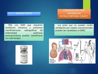 SURFACTANTE
- RNs con SAM que requieren
ventilación mecánica y presentan
manifestaciones radiográficas de
enfermedad pulmonar
parenquimatosa pueden beneficiarse
con esta terapia
OXIGENACIÓN POR
MEMBRANA
EXTRACORPÓREA (OMEC)
- Los pctes que no pueden recibir
ventilación por medios convencionales
pueden ser candidatos a OMEC
 