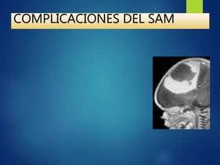 COMPLICACIONES DEL SAM
 