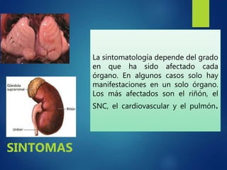 La sintomatología depende del grado
en que ha sido afectado cada
órgano. En algunos casos solo hay
manifestaciones en un solo órgano.
Los más afectados son el riñón, el
SNC, el cardiovascular y el pulmón.
SINTOMAS
 