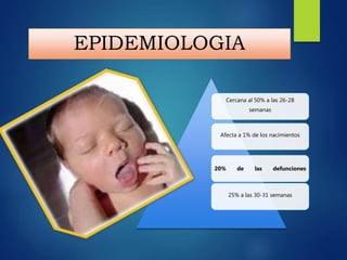 EPIDEMIOLOGIA
Cercana al 50% a las 26-28
semanas
Afecta a 1% de los nacimientos
20% de las defunciones
25% a las 30-31 semanas
 