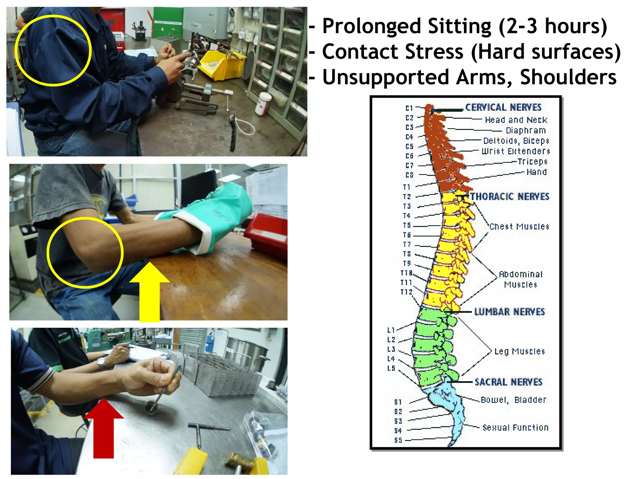 - Prolonged Sitting (2-3 hours)
- Contact Stress (Hard surfaces)
- Unsupported Arms, Shoulders
 