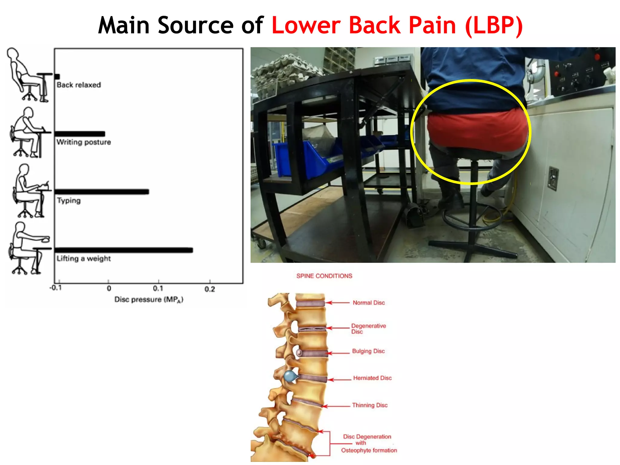 Main Source of Lower Back Pain (LBP)
 