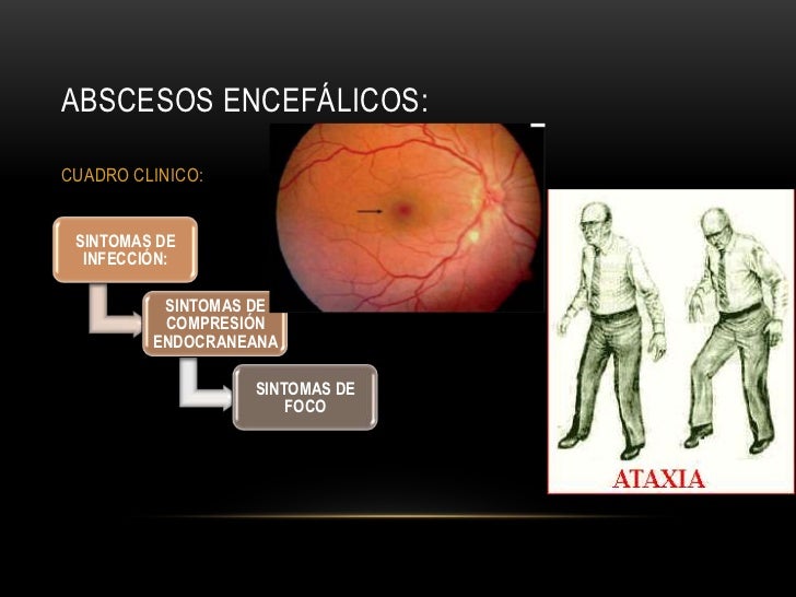 El diagnóstico en la cirugía vascular