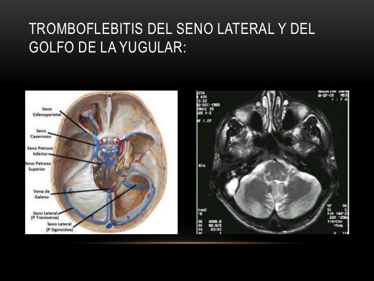 La cirugía federal vascular perm