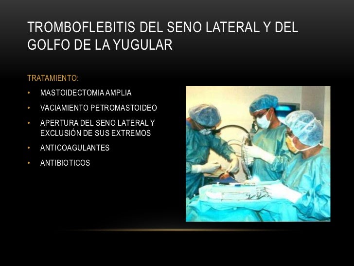El tratamiento a la várice varicosa de las extremidades inferiores