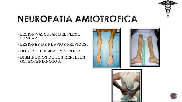 Complicaciones agudas y cronicas de la diabetes mellitus Complicaciones agudas y cronicas de la diabetes mellitus