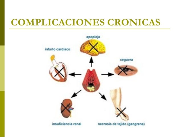 Complicaciones de la Diabetes Mellitus Complicaciones de la Diabetes Mellitus