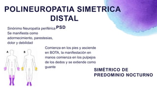 Comienza en los pies y asciende
en BOTA, la manifestación en
manos comienza en los pulpejos
de los dedos y se extiende como
guante
SIMÉTRICO DE
PREDOMINIO NOCTURNO
POLINEUROPATIA SIMETRICA
DISTAL
Sinónimo Neuropatía periférica
Se manifiesta como
adormecimiento, parestesias,
dolor y debilidad
PSD
 