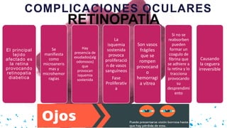 RETINOPATÍA
COMPLICACIONES OCULARES
El principal
tejido
afectado es
la retina
provocando
retinopatia
diabetica
Se
manifiesta
como
microaneris
mas y
microhemor
ragias
Hay
presencia de
exudados(alg
odonosos)
que
provocan
isquemia
sostenida
La
isquemia
sostenida
provoca
proliferació
n de vasos
sanguíneos
Fase
Proliferativ
a
Son vasos
frágiles
que se
rompen
provocand
o
hemorragi
a vítrea
Si no se
reabsorben
pueden
formar un
coagulo de
fibrina que
se adhiere a
la retina y lo
tracciona
provocando
su
desprendimi
ento
Causando
la ceguera
irreversible
 