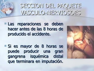 SECCION DEL PAQUETE
          VASCULO-NERVIOSOES
   Las reparaciones se deben
    hacer antes de las 8 horas de
    producido el accidente.

   Si es mayor de 8 horas se
    puede producir una gran
    gangrena isquémica distal
    que terminara en imputación.
 